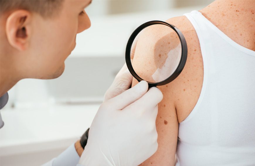 Skóra, zwierciadło zdrowia naszego organizmu